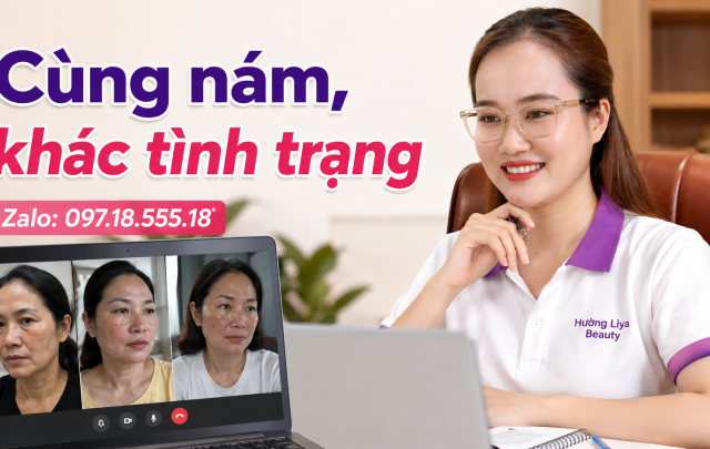 Cùng bị nám, vì sao khác nhau
