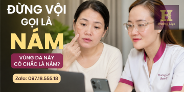 Đừng vội gọi là nám