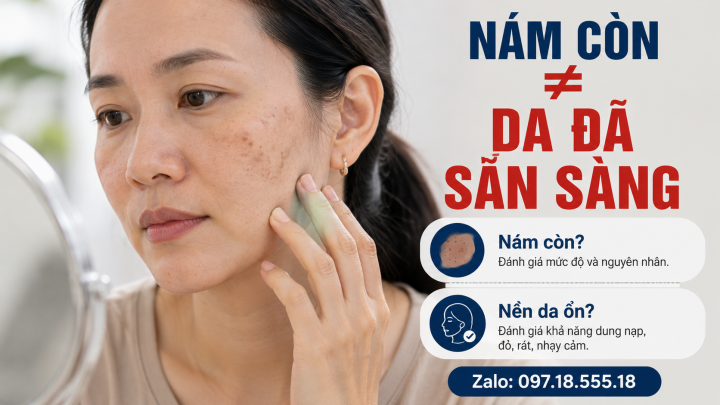Khi phân biệt trạng thái da và tình trạng nám