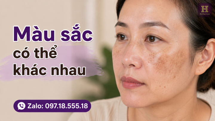 Màu sắc có thể khác nhau Màu sắc có thể khác nhau