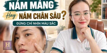 Nám Mảng Hay Nám Chân Sâu