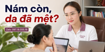 Nám còn, da đã mệt