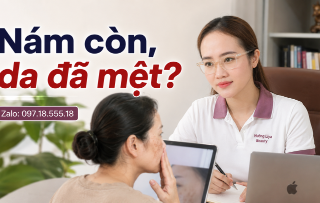 Nám còn, da đã mệt