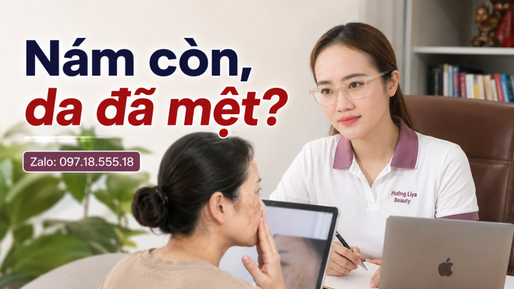 Nám còn, da đã mệt