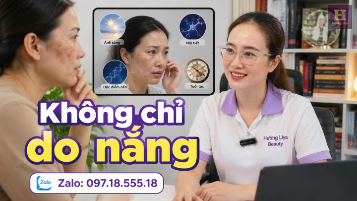 Vì sao da xuất hiện nám