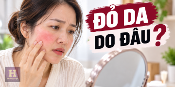 ĐỎ DA DO ĐÂU