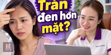 Da trán đen hơn da mặt thì phải làm sao