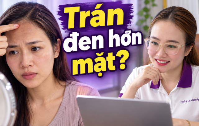 Da trán đen hơn da mặt thì phải làm sao