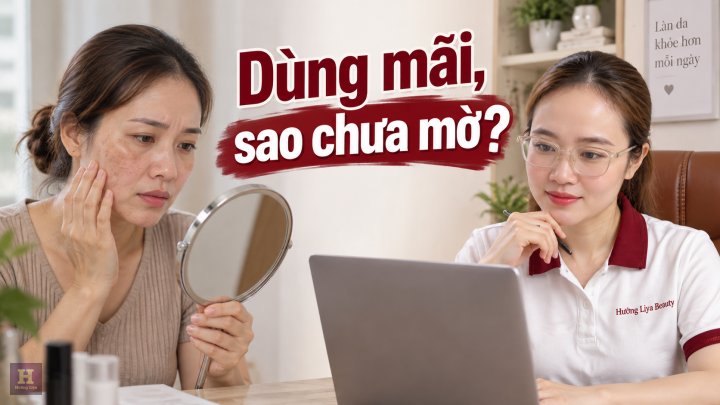Dùng kem trị nám bao lâu thì có tác dụng Khi nào đánh giá
