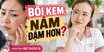 Vì sao dùng kem trị nám các vết nám lại đậm hơn