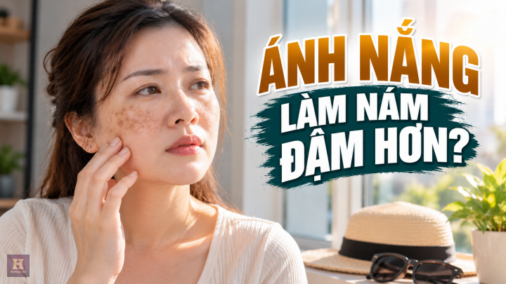 Ánh Nắng Làm Nám Đậm Hơn