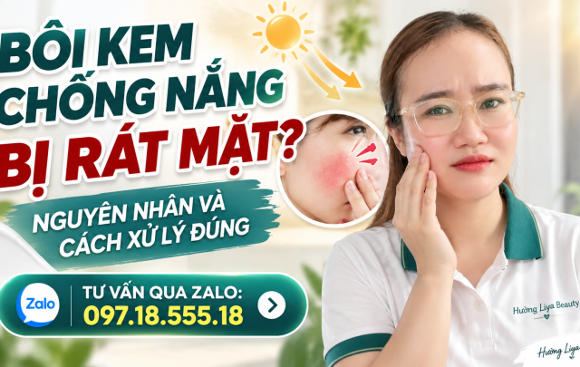 Bôi Kem Chống Nắng Bị Rát Mặt
