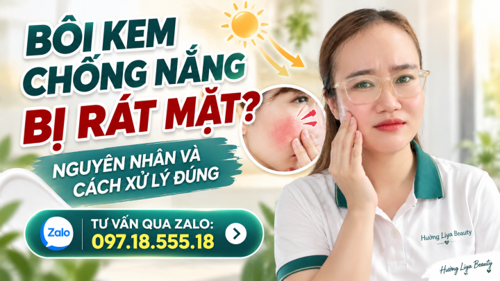 Bôi Kem Chống Nắng Bị Rát Mặt