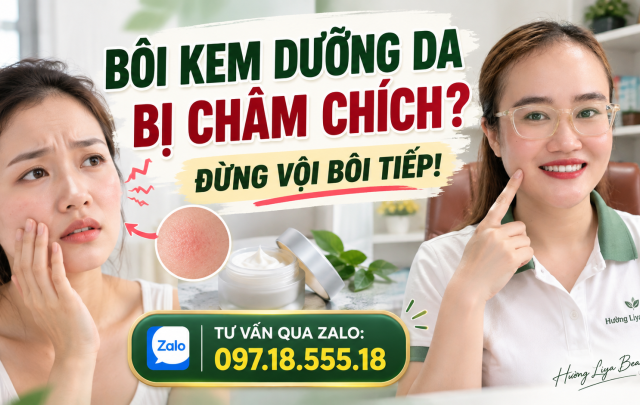Bôi kem dưỡng da bị châm chích