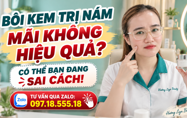 Bôi kem trị nám mãi không hiệu quả