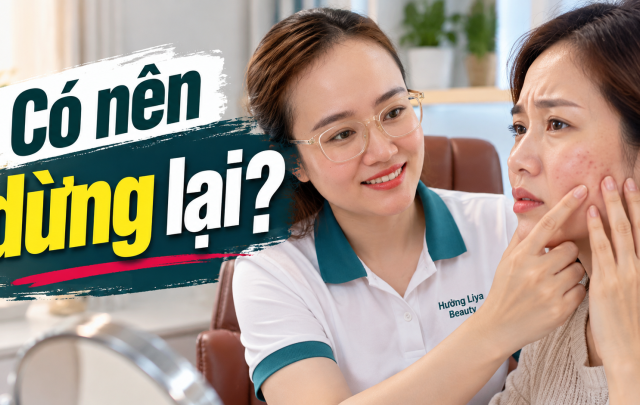 Khi nào nên ngừng một sản phẩm skincare?