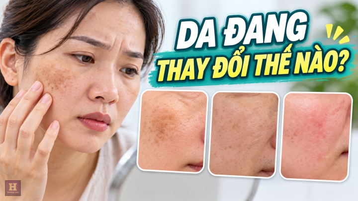 Da Đang Thay Đổi Thế Nào Da Đang Thay Đổi Thế Nào