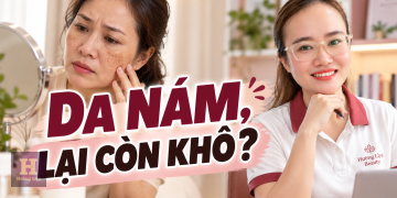 Kem Trị Nám Cho Tuổi 40: Cách Chọn Theo Tình Trạng Da