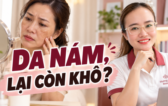 Kem Trị Nám Cho Tuổi 40: Cách Chọn Theo Tình Trạng Da