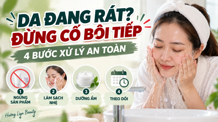 Da Rát 4 Bước Xử Lý An Toàn