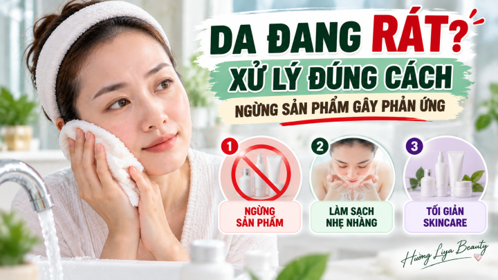 Da Rát Xử Lý Đúng Cách
