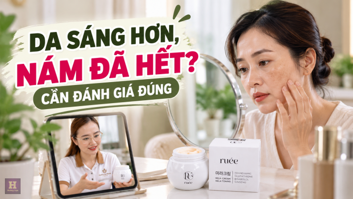 Da sáng hơn, nám đã hết