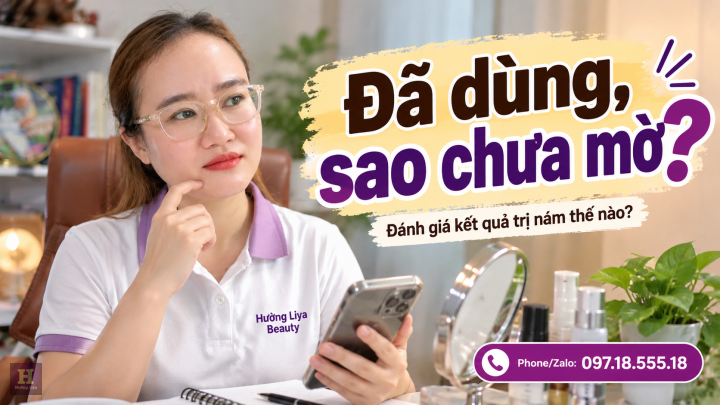 Dùng Kem Trị Nám Bao Lâu Thì Nên Đánh Giá Kết Quả