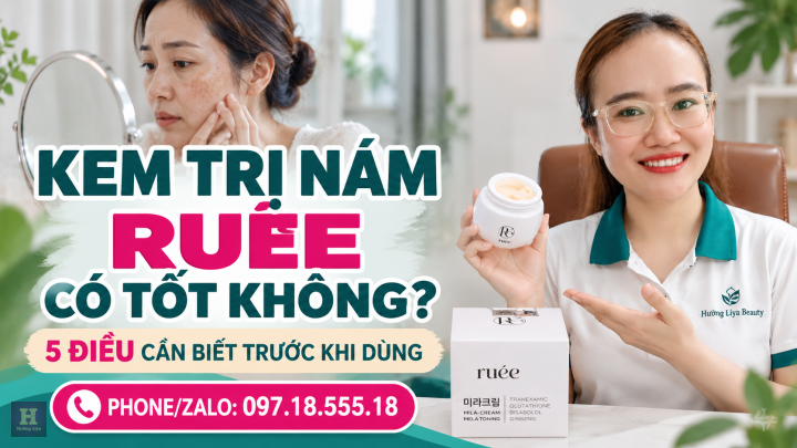 Kem Trị Nám Ruée 5 Điều Cần Biết
