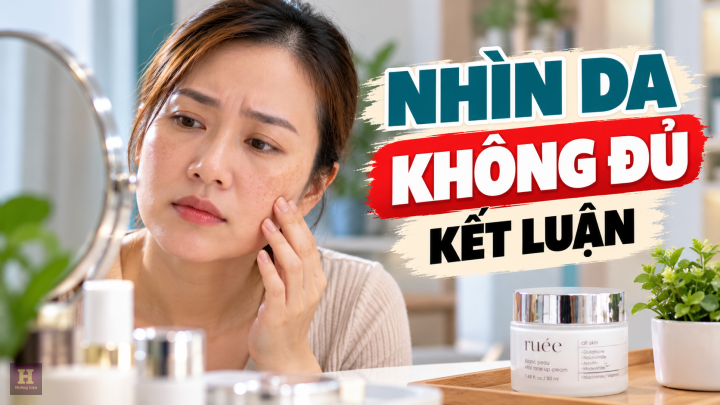 Nhìn Da, Đừng Vội Kết Luận Nhìn Da, Đừng Vội Kết Luận