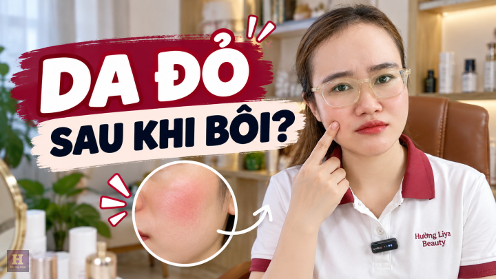 RUEE Dùng Bị Đỏ Da Nên Làm Gì Và Khi Nào Cần Khám