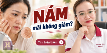 Thuốc Trị Nám Tại Bệnh Viện Da Liễu Những Điều Cần Biết