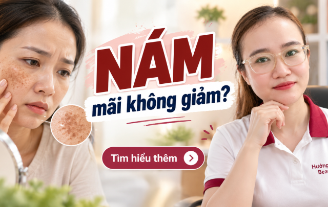 Thuốc Trị Nám Tại Bệnh Viện Da Liễu Những Điều Cần Biết
