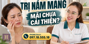 Cách Trị Nám Mảng Hiệu Quả: Chăm Sóc Da Đúng Cách