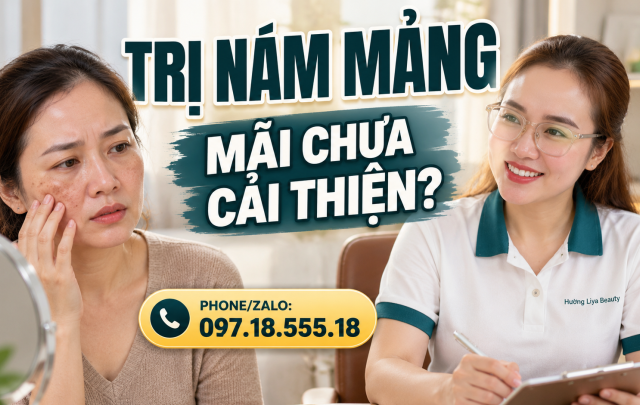 Cách Trị Nám Mảng Hiệu Quả: Chăm Sóc Da Đúng Cách