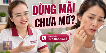 Top 6 kem trị nám tốt nhất, So sánh gì trước khi chọn?