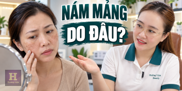 Nám Mảng Do Đâu? Nguyên Nhân Và Yếu Tố Liên Quan