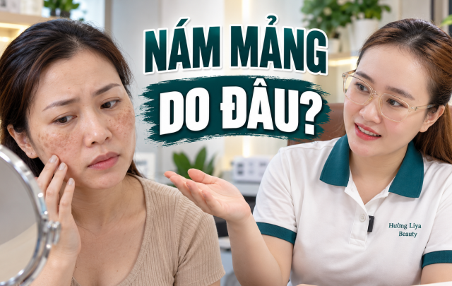 Nám Mảng Do Đâu? Nguyên Nhân Và Yếu Tố Liên Quan