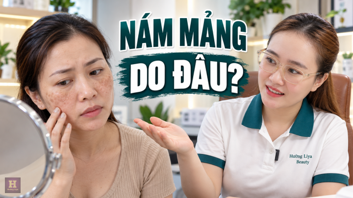 Nám Mảng Do Đâu? Nguyên Nhân Và Yếu Tố Liên Quan