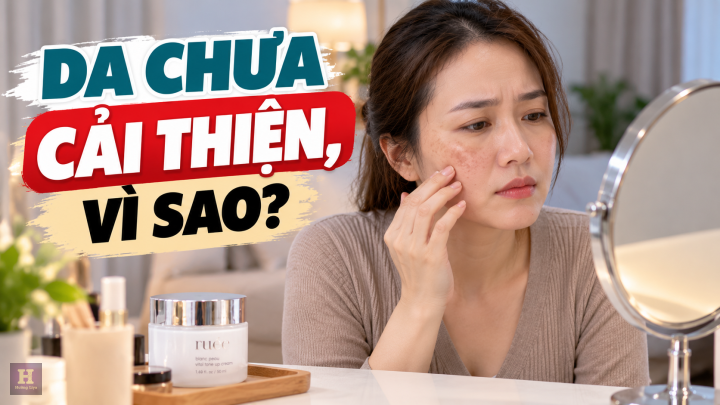 Vì Sao Da Chưa Cải Thiện Vì Sao Da Chưa Cải Thiện
