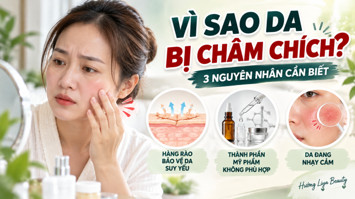 Vì sao da bị châm chích